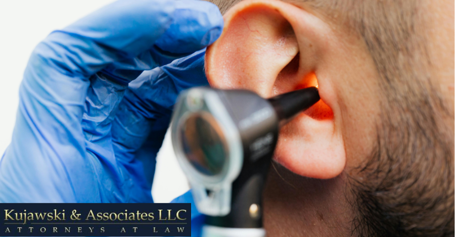 Can Railroad Workers Recover Compensation for Hearing Loss?
